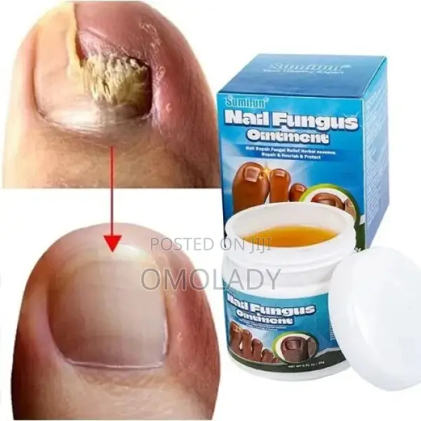 Sumifun Nail Fungus Ointment-20g