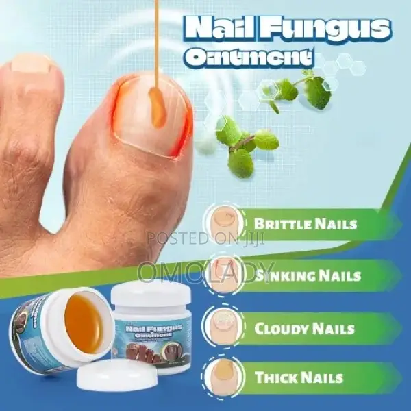 Sumifun Nail Fungus Ointment-20g