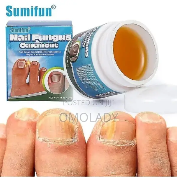 Sumifun Nail Fungus Ointment-20g