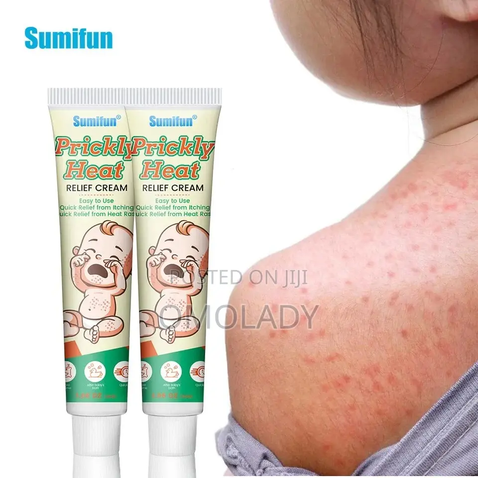 Sumifun Prickly Heat Relief Cream for Babies