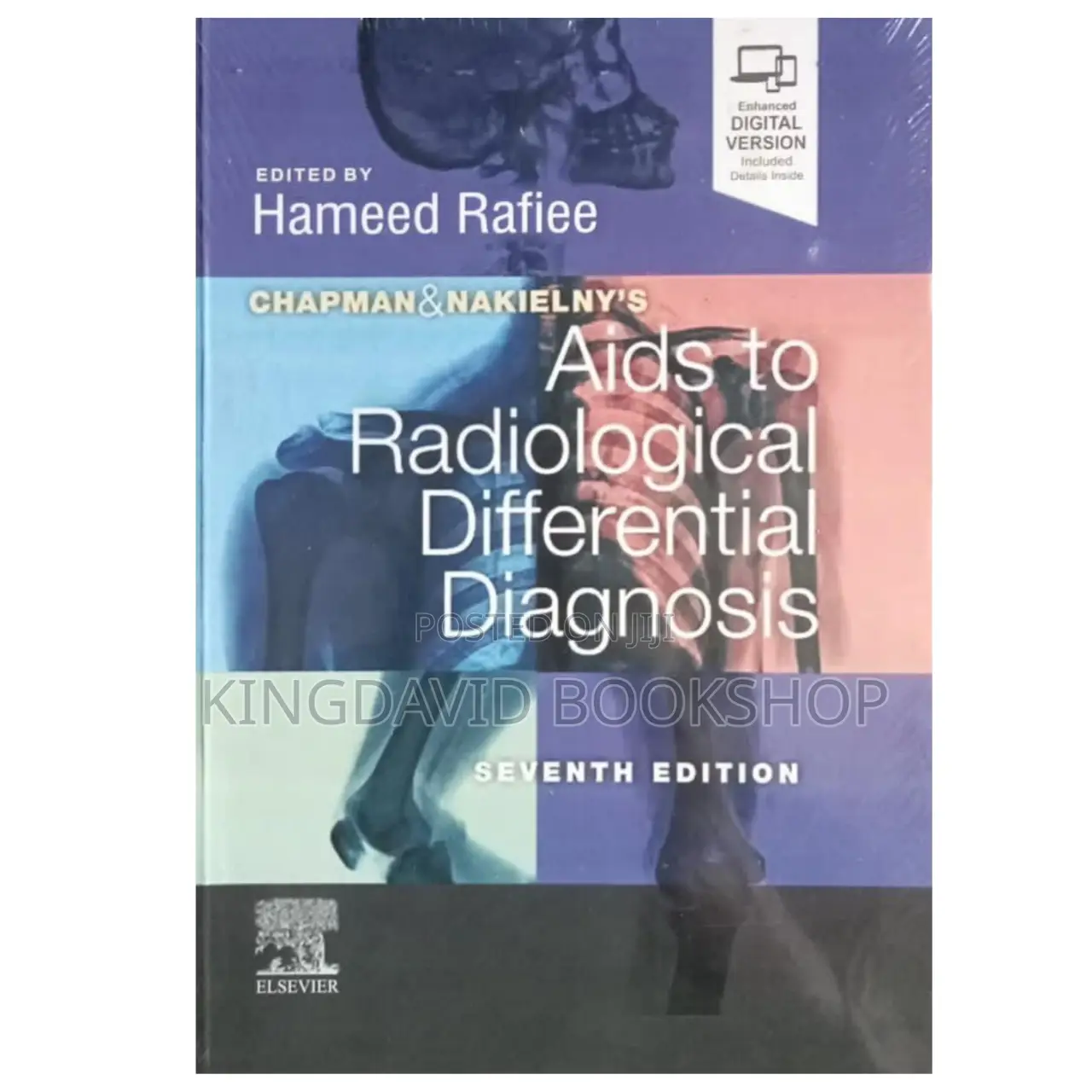 Aids to Radiological Differential Diagnosis