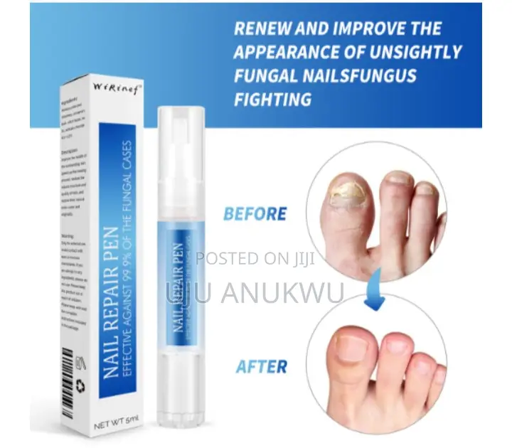 99.9% Effective Anti Fungal Nail Repair and Correction Pen