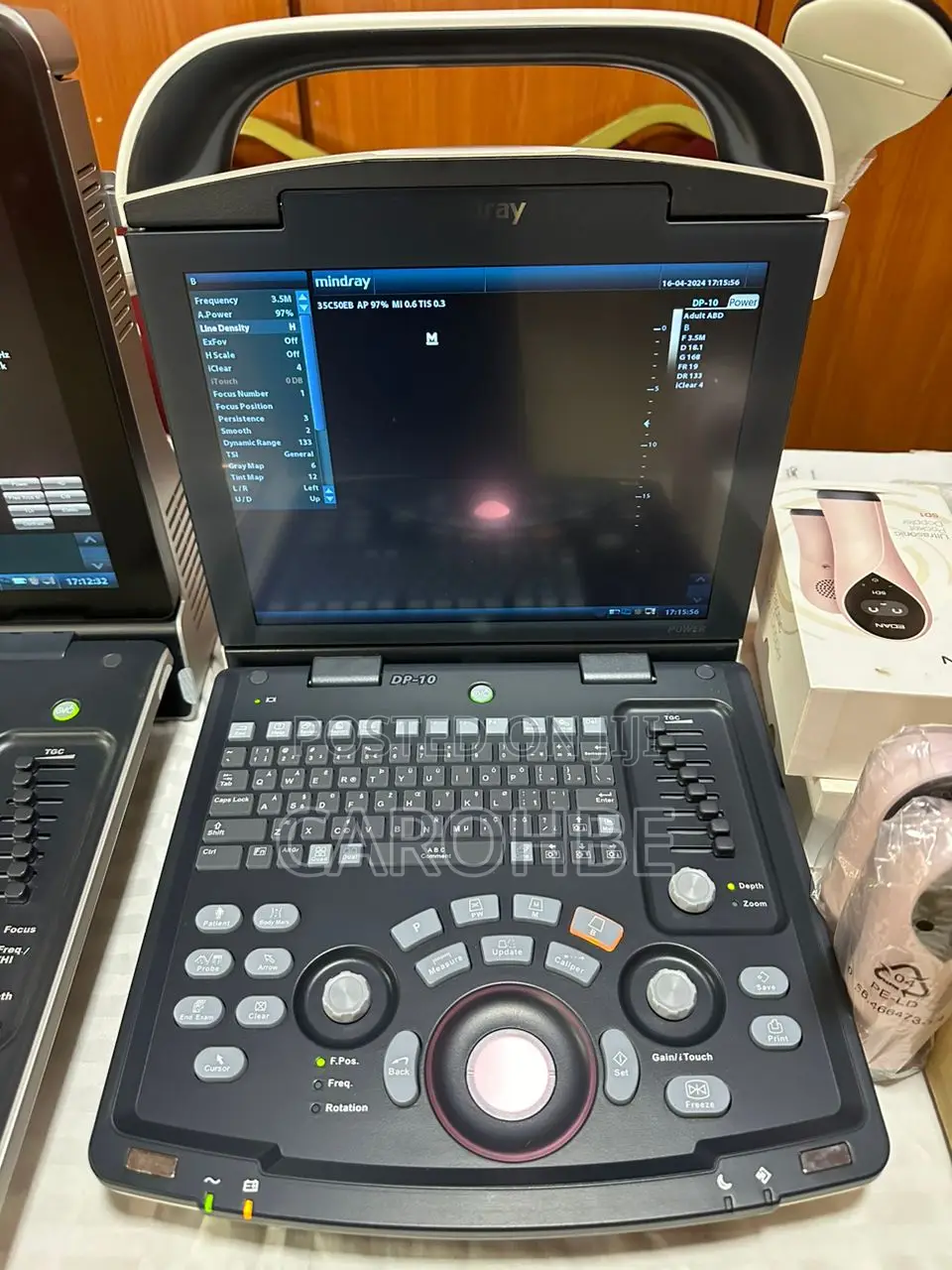 Uultrasound