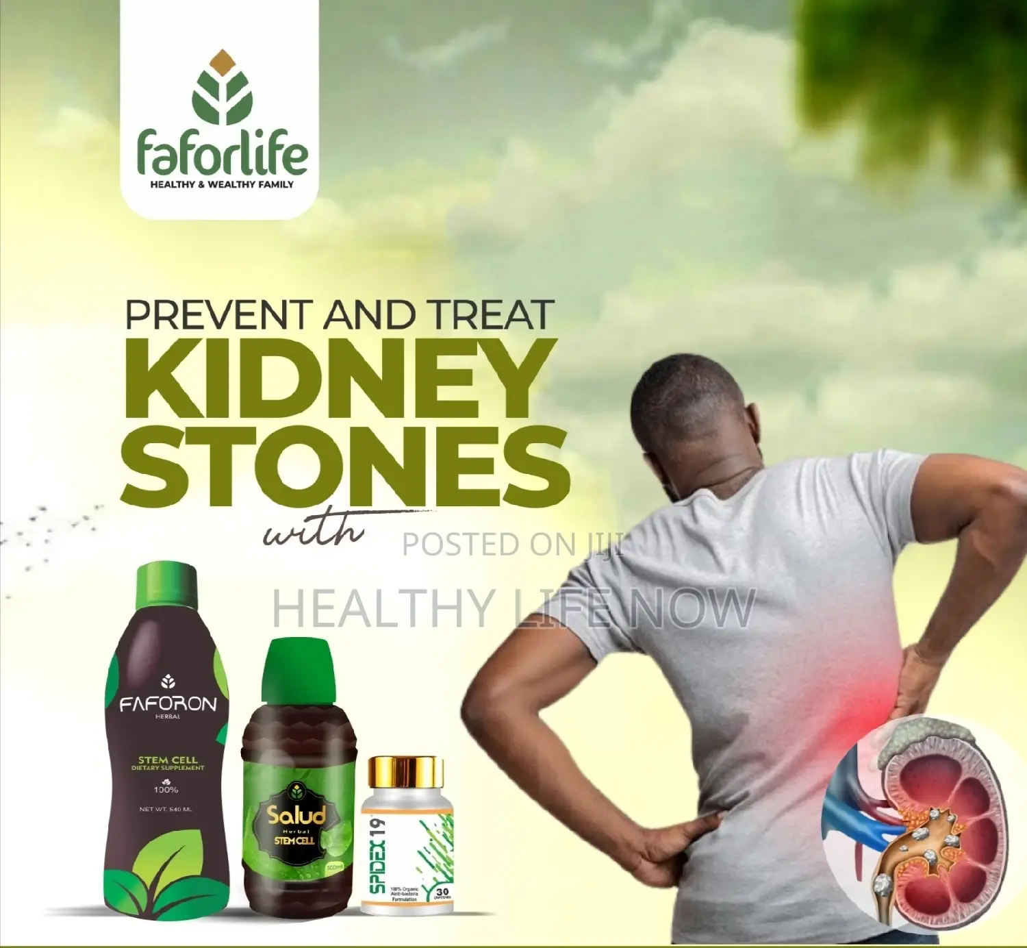 Treat Kidney Stones With Faforlife Organic Stemcell