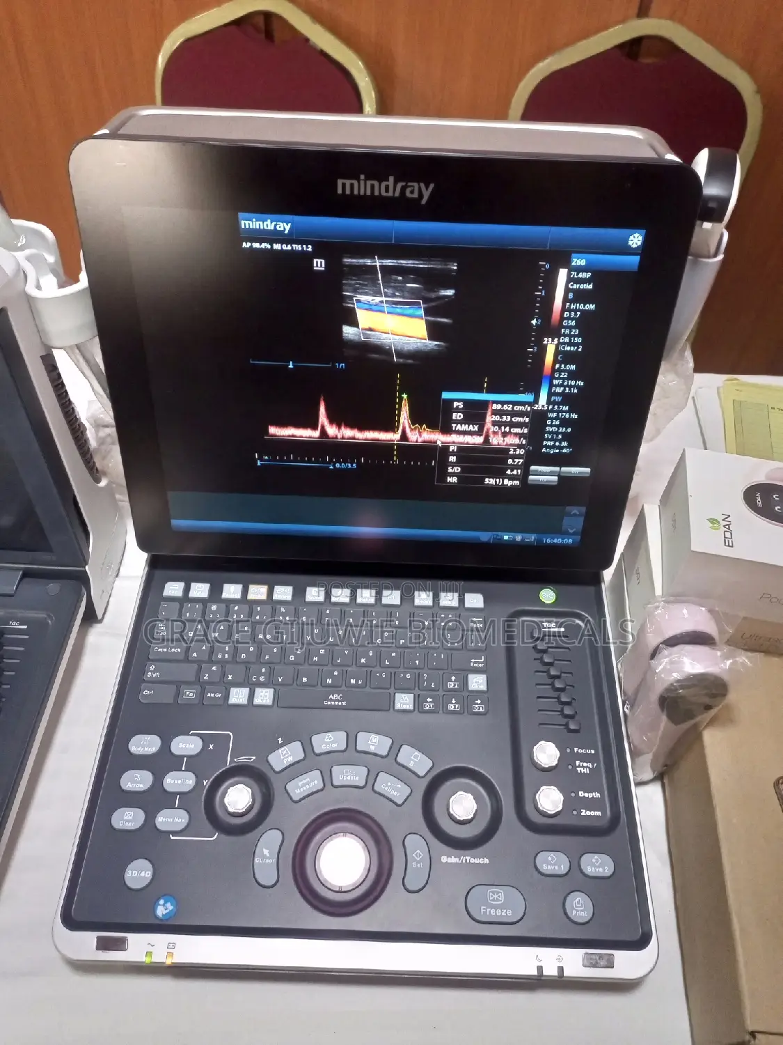 Colour Doppler Mindray 4d Ultrasound Machine