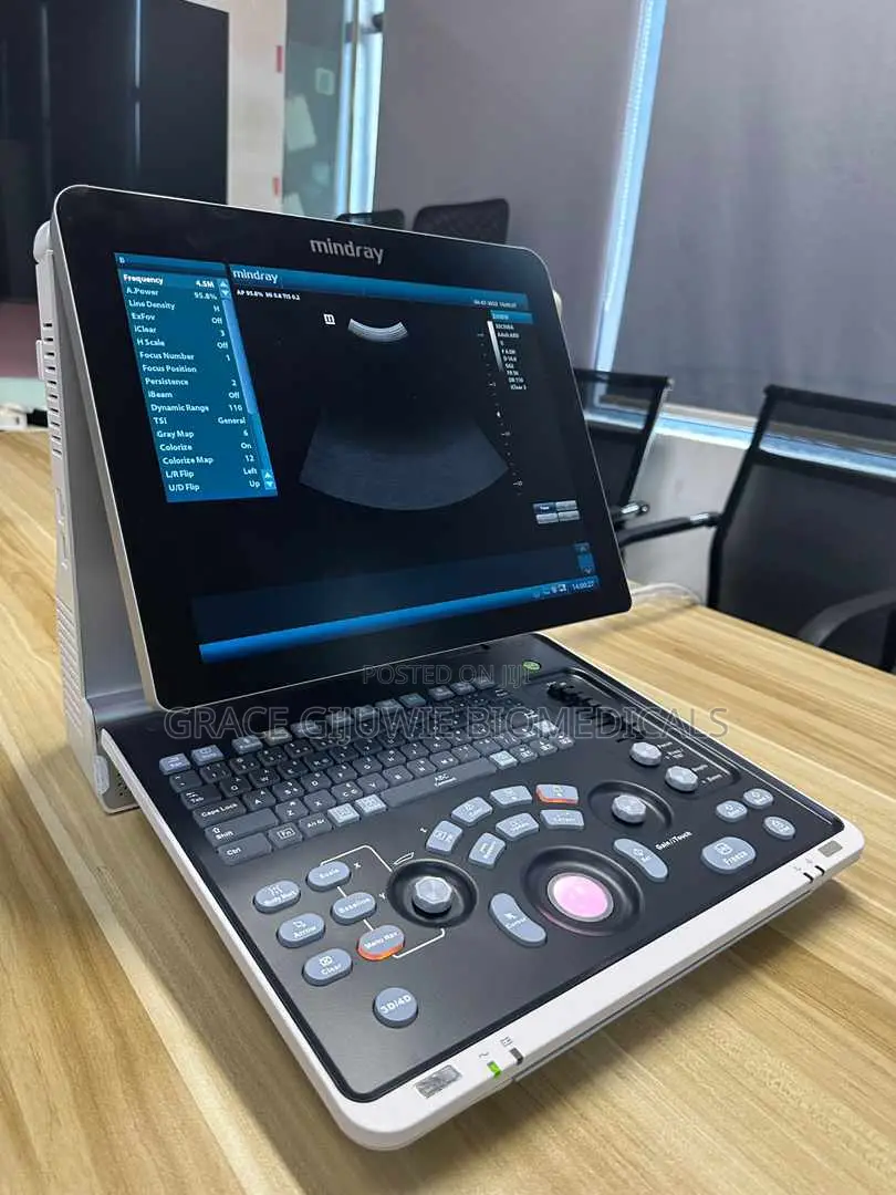 Mindray Ultrasound Machine Z60