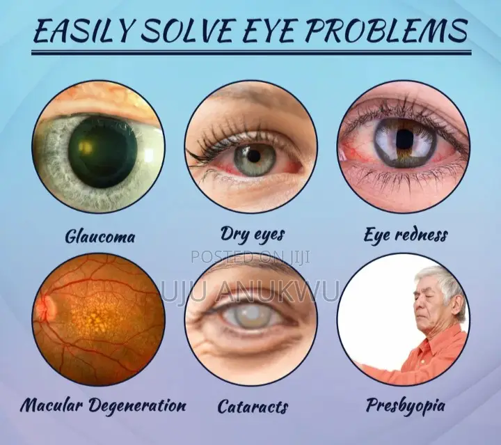 Eye Repair Therapy 4 Cataract, Glaucoma Eye Ailment