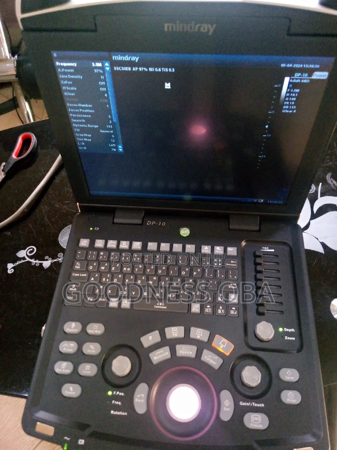 Mindray Dp 10 Ultrasound Machine