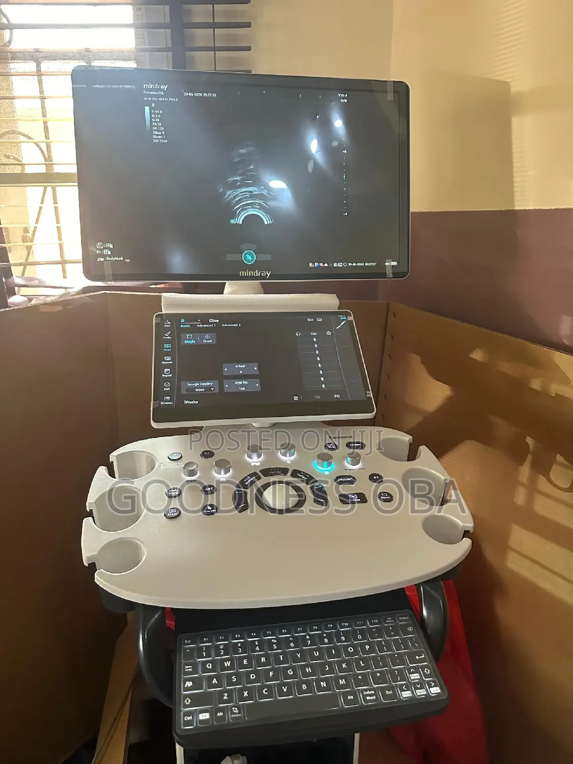 Mindray Consona N6 Ultrasound Machine
