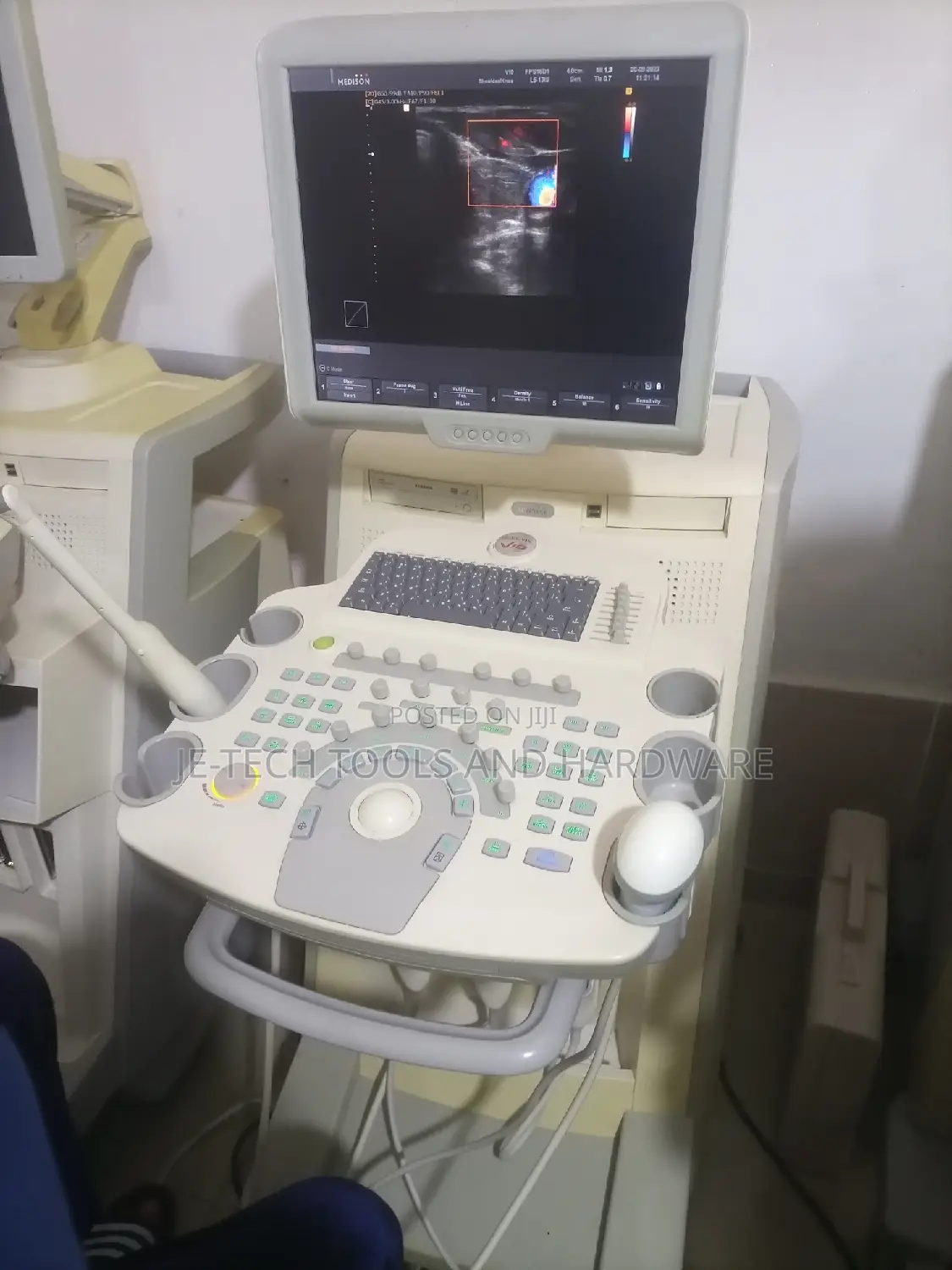 4D Samsung Sonoace V10 Ultrasound Machine