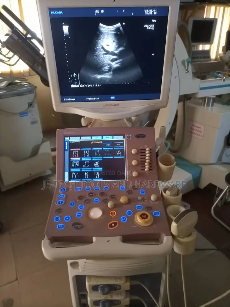 Aloka Prosound Alpha 6 Ultrasound System ( Cardiac)
