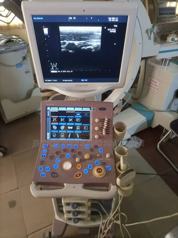 Aloka Prosound Alpha 6 Ultrasound System ( Cardiac)
