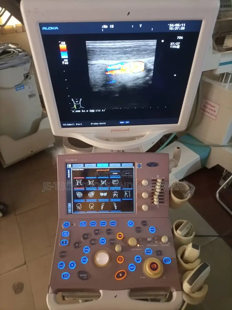 Aloka Prosound Alpha 6 Ultrasound System ( Cardiac)