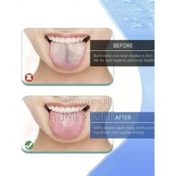 12 Pieces Tongue Scraper Product Code: 6414106