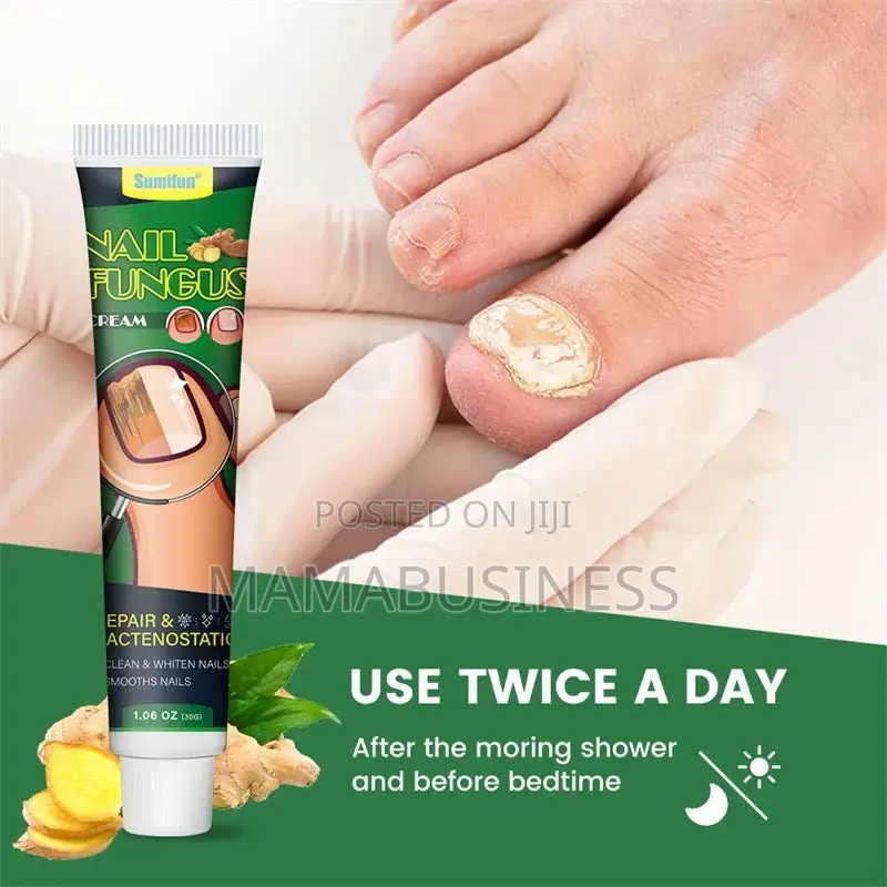 Sumifun Nail Fungus Treatment Cream-30g