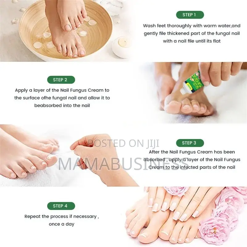 Sumifun Nail Fungus Treatment Cream-30g