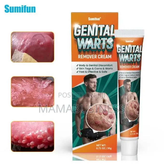 Sumifon Genital Wart Removal Cream-20g