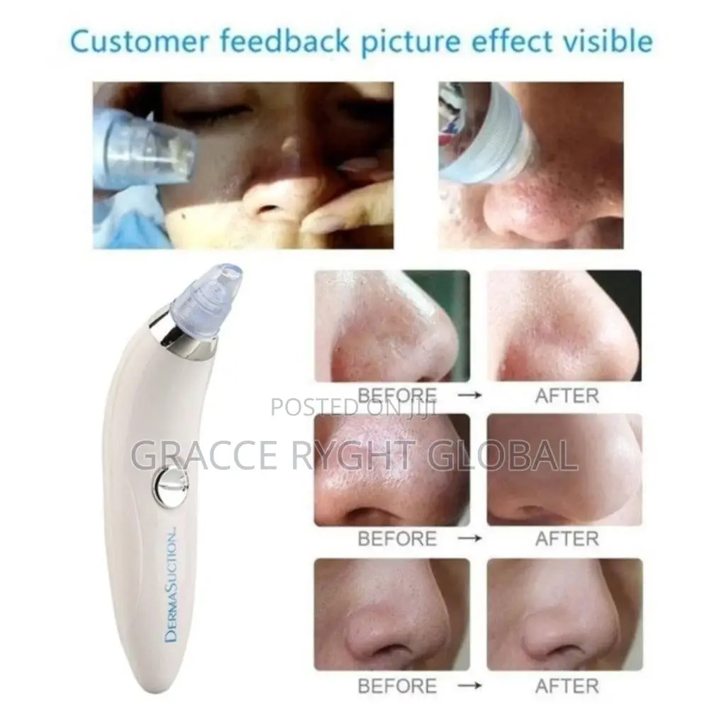 Derma Suction Pores Cleaner