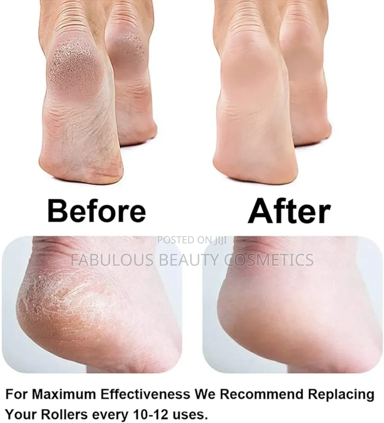 Callus Remover Rechargeable Pedicure Tool for Dead Skin.