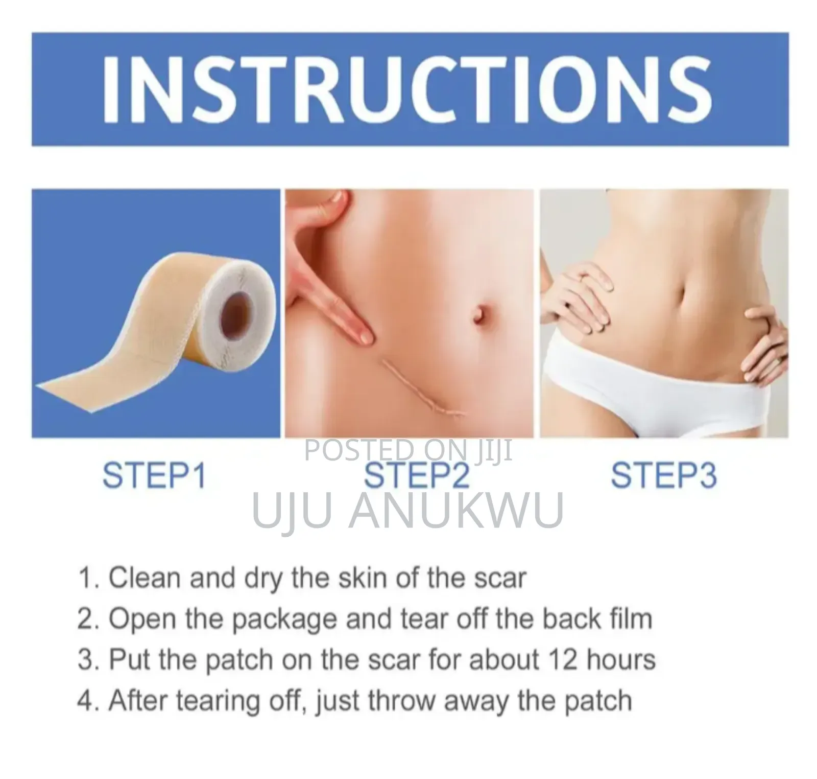 High Quality Silicone Scar Sheet For All Scars And Keloid
