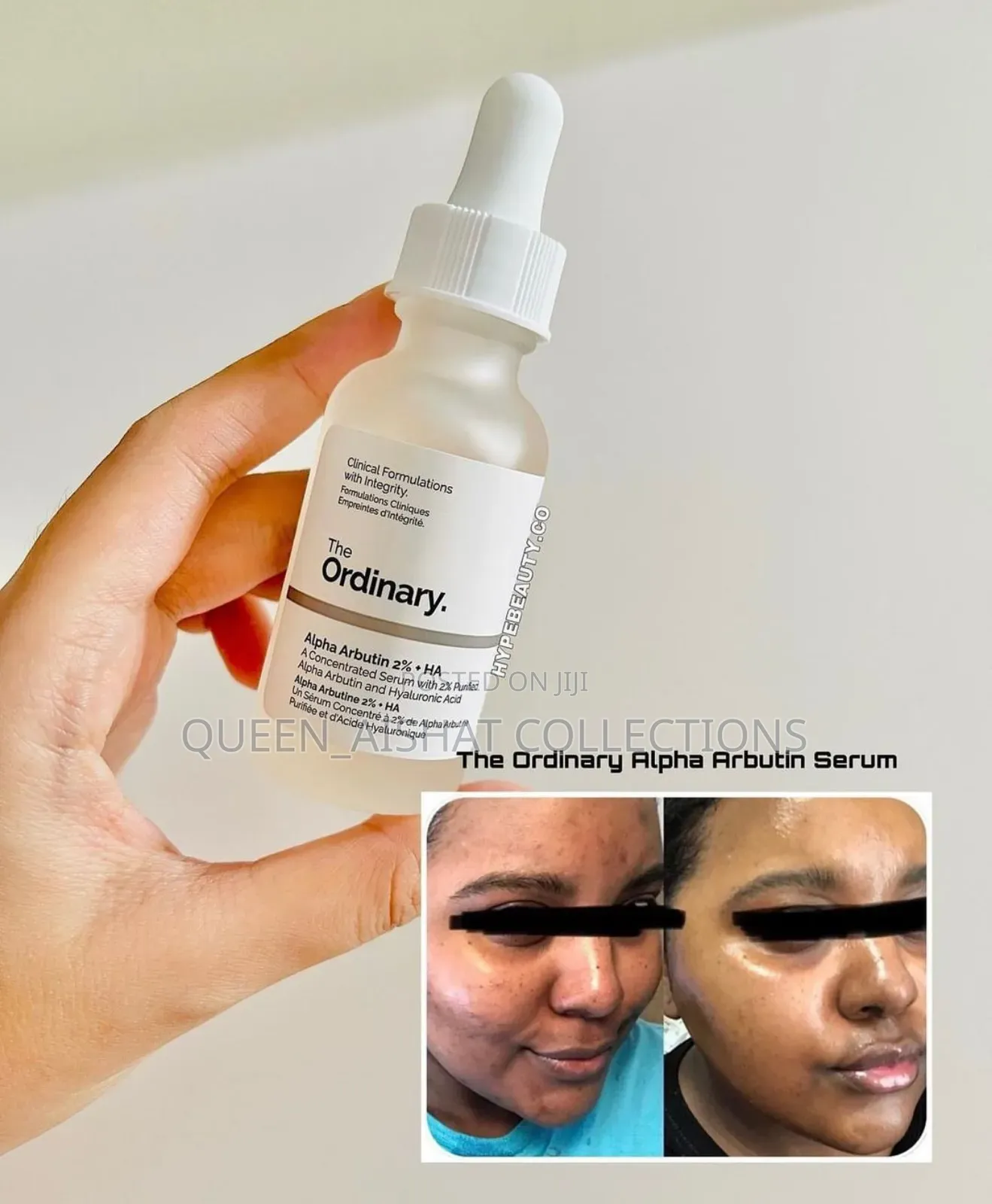 The Ordinary Alpha Arbutin 2%+Ha