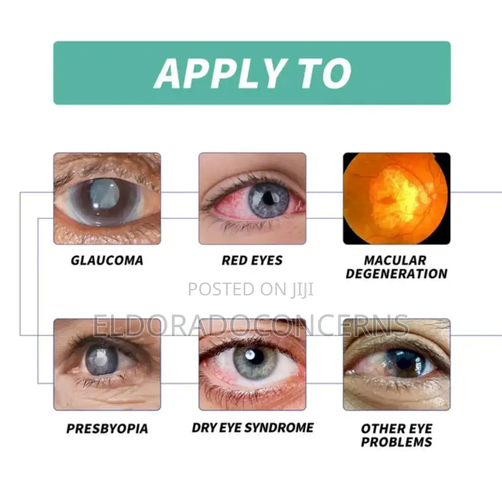 Eelhoe Vision Enhance Roller(Wholesale 20+)
