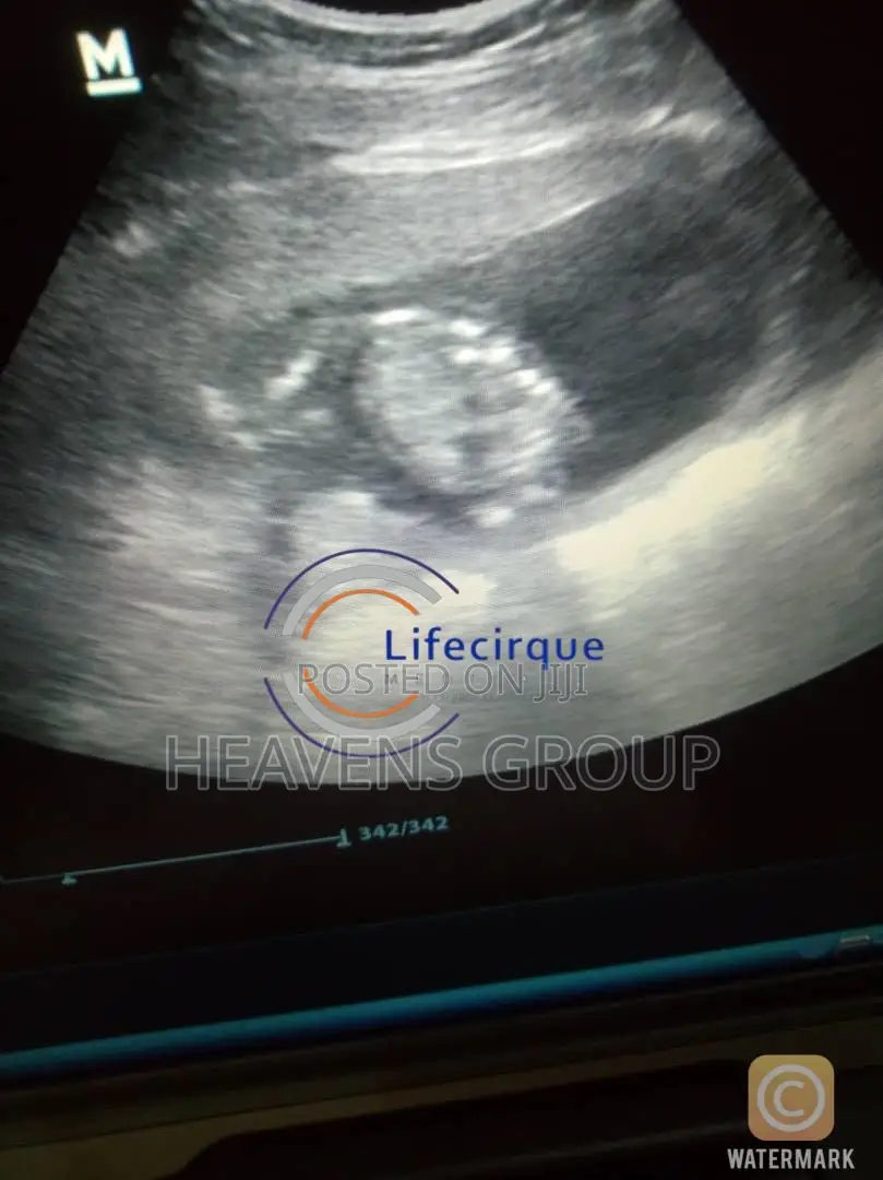 Ivf Surrogacy at Discounted Rates in Nigeria - Lifecirque