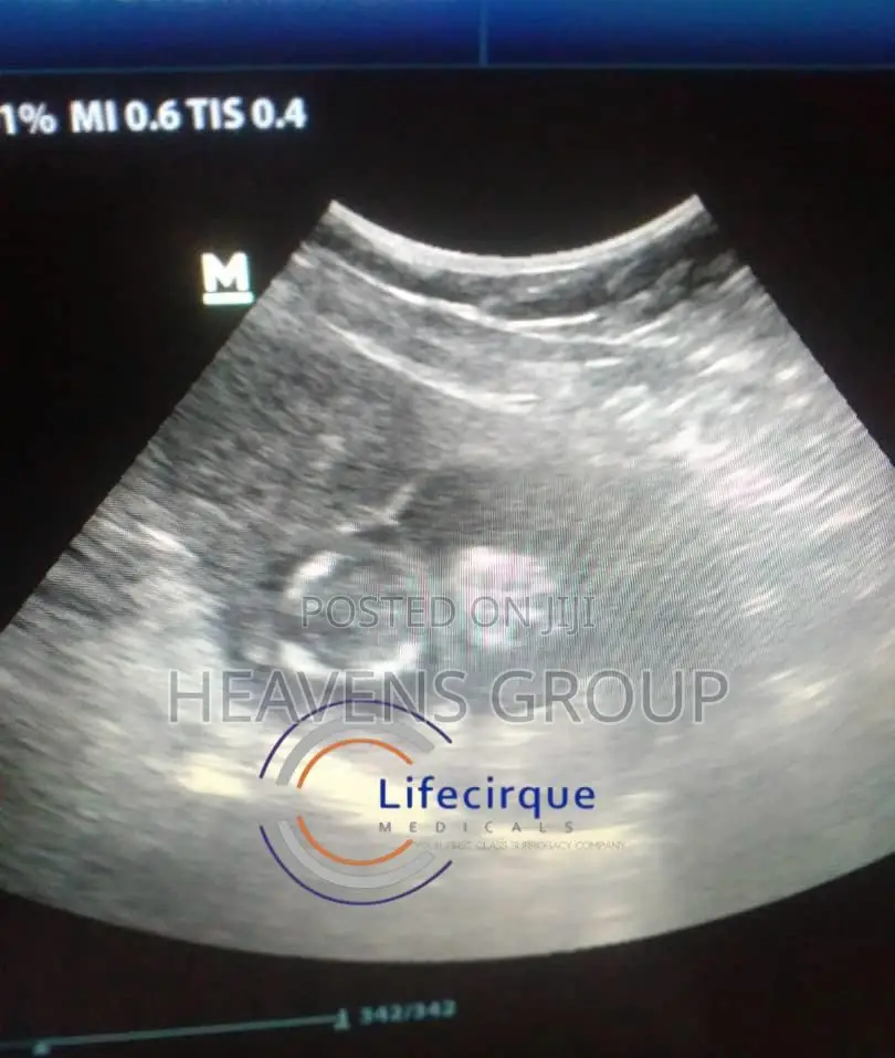 Ivf Surrogacy at Discounted Rates in Nigeria - Lifecirque