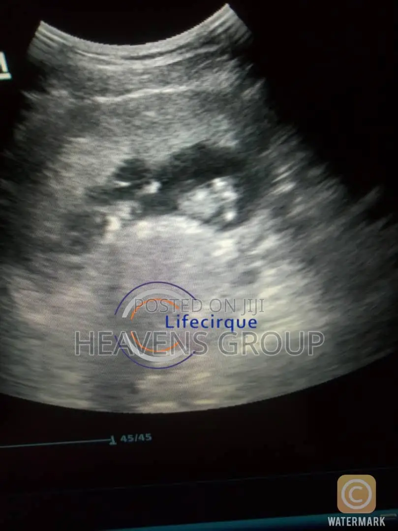 Ivf Surrogacy at Discounted Rates in Nigeria - Lifecirque