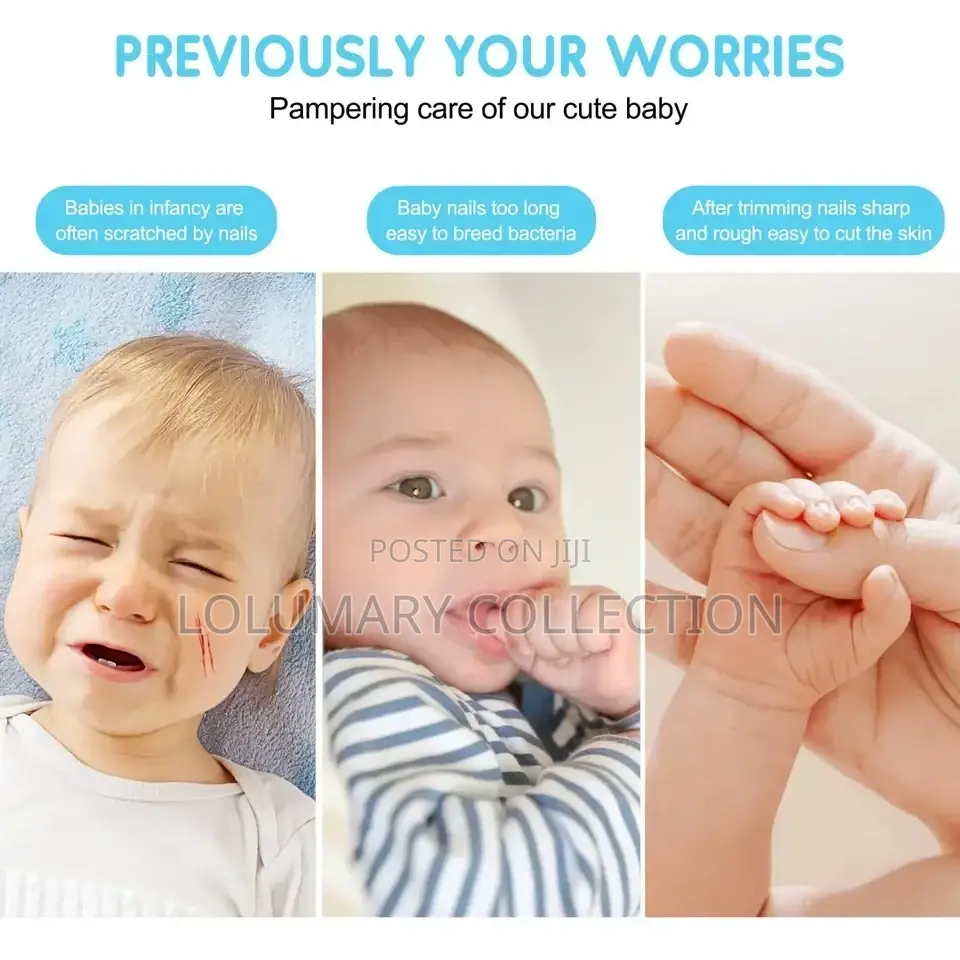 Electric Baby Nail Trimmer – Battery Powered Baby-Friendly