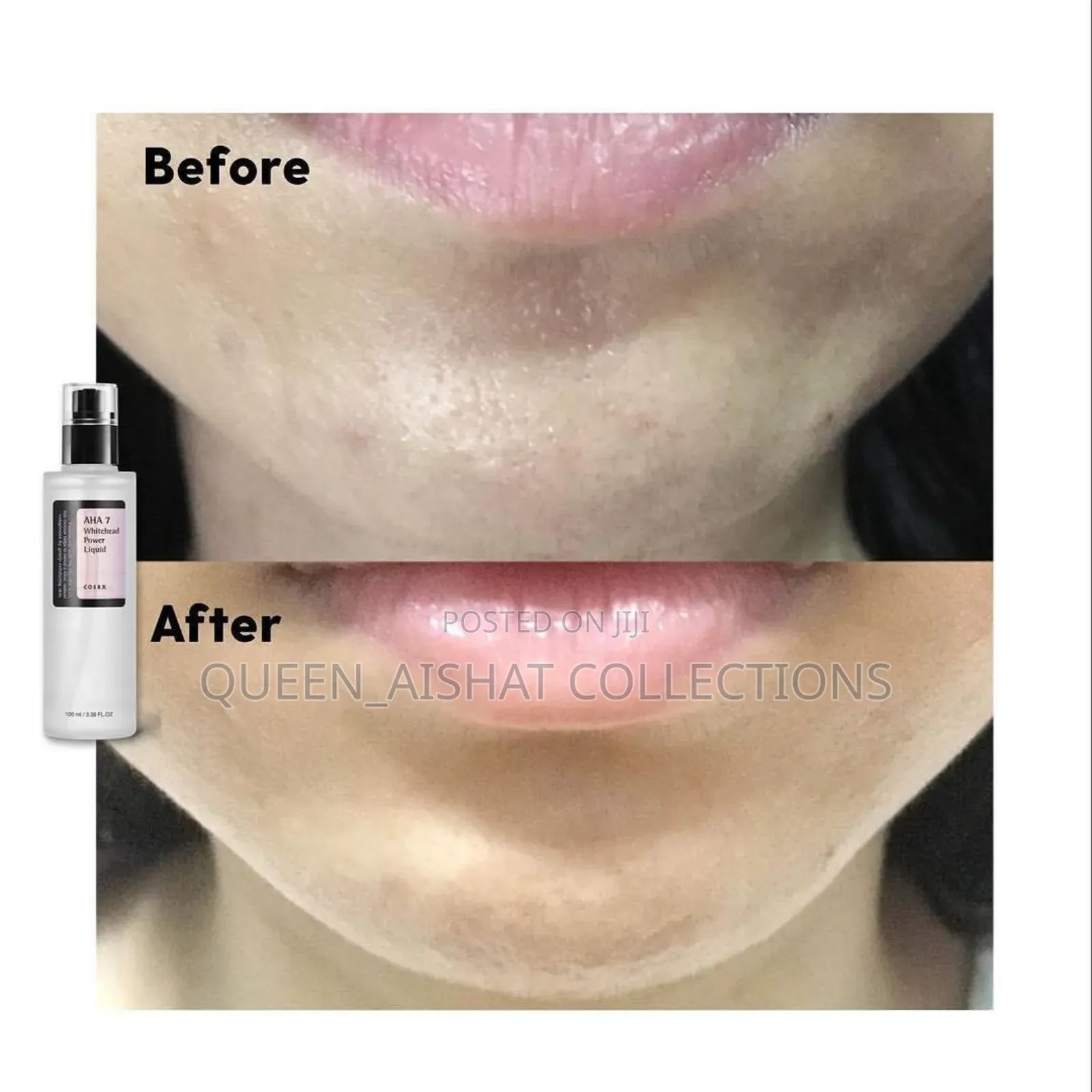 Cosrx Aha/Bha Clarifying Treatment Toner