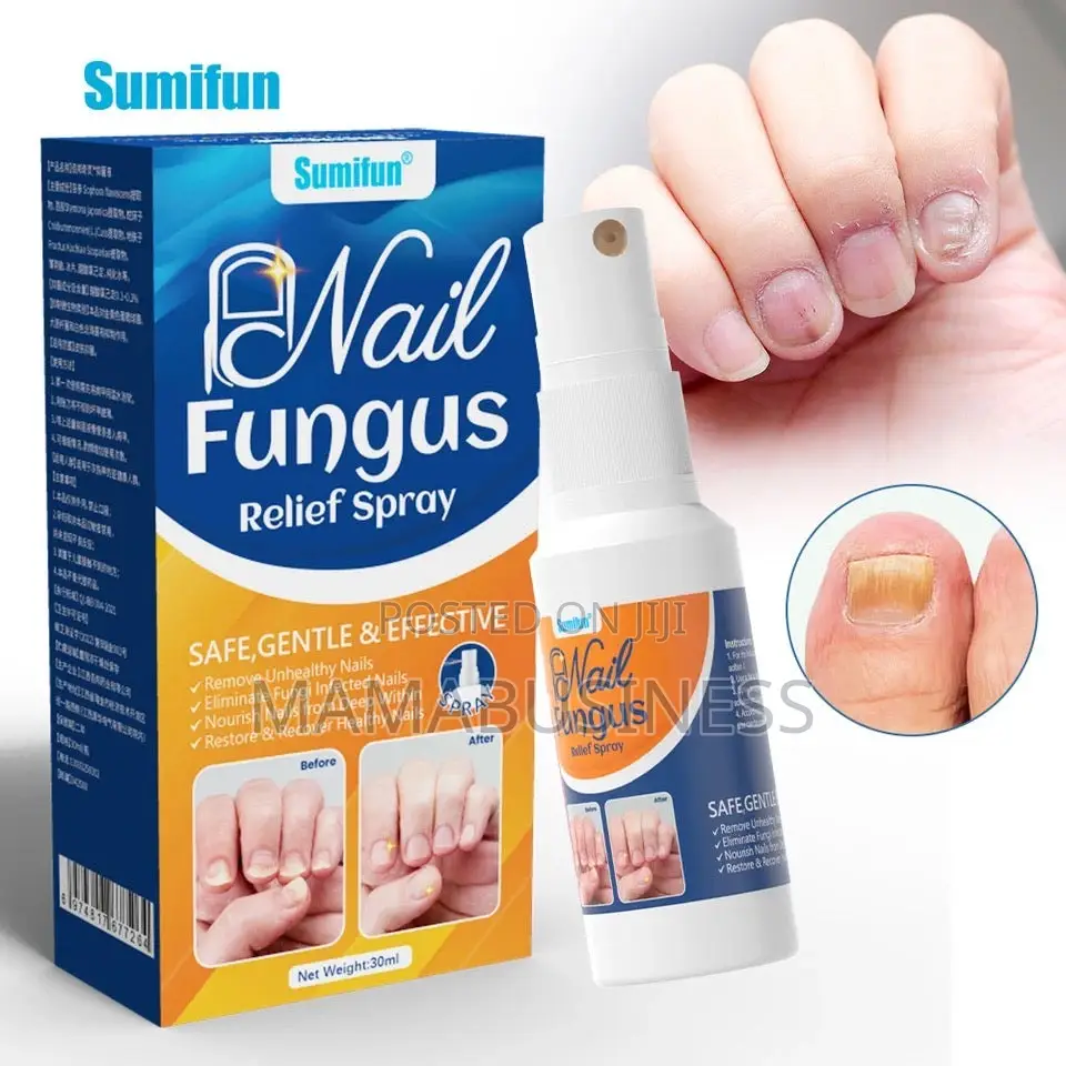 Sumifun Nail Fungus Relief Spray-30ml