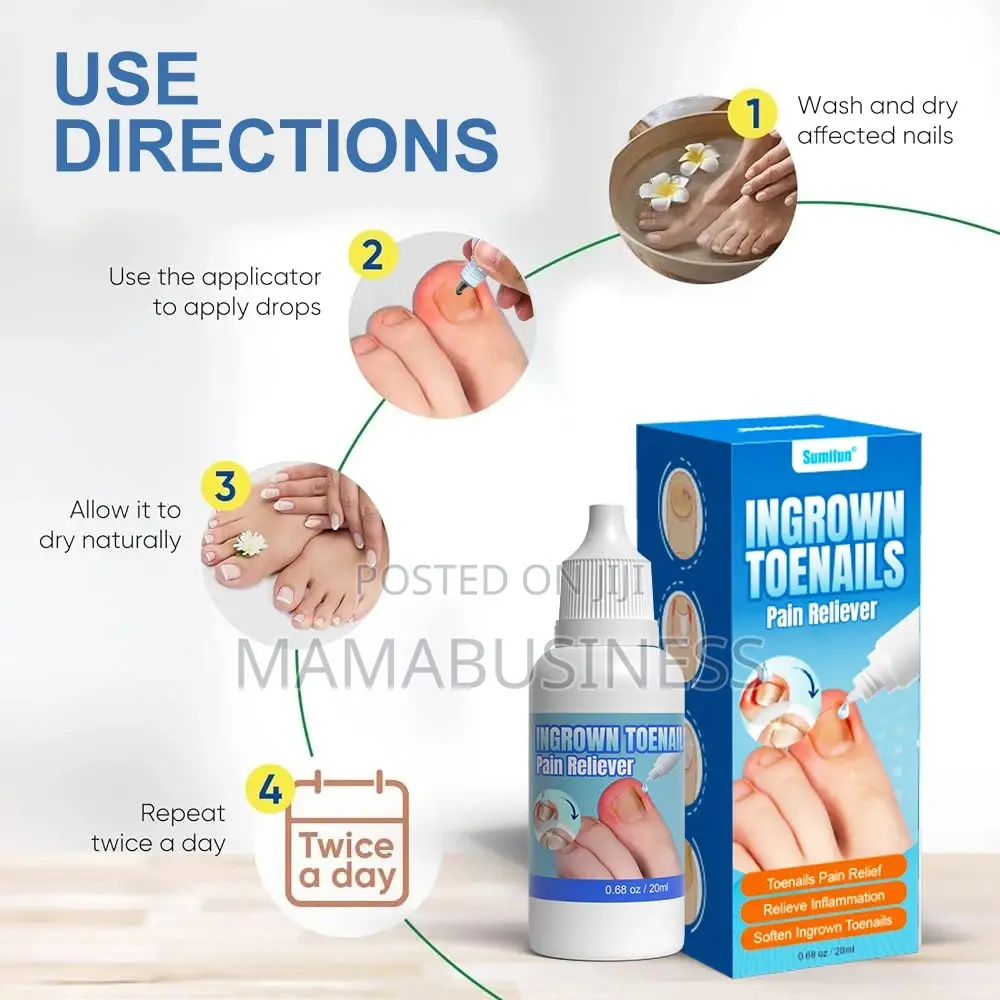 Sumifun Ingrown Toenails Pain Reliever-20ml
