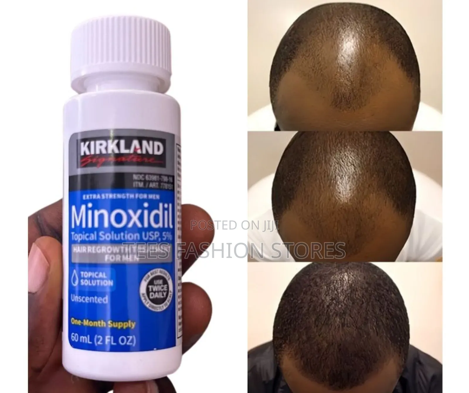 Kirkland Signature Minoxidil Hair Regrowth Solution - 60ml