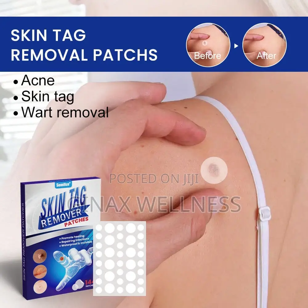 Skin Tag Remover Patches (144 Patches) | Patch for Skin Tags