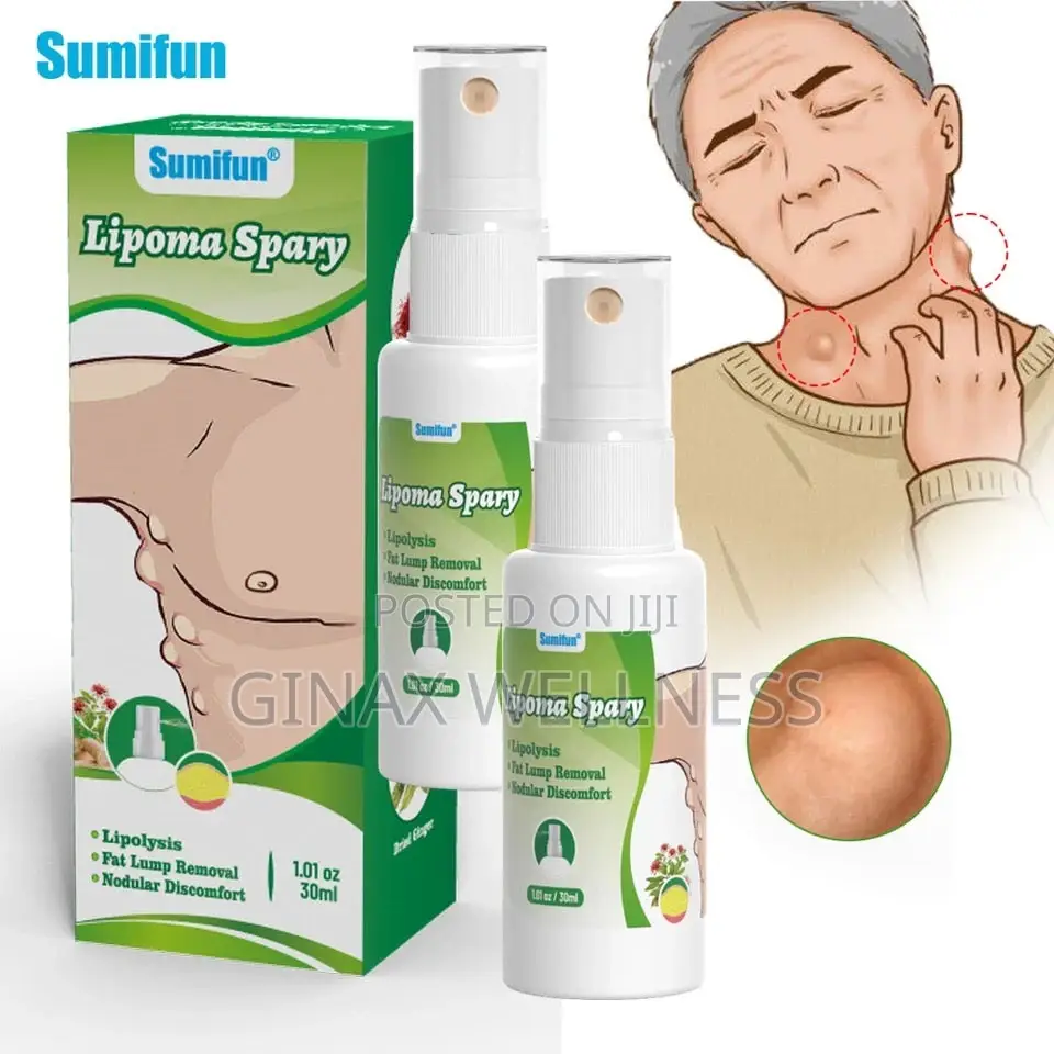Lipoma Spray |Topical Spray For Skin Lump And Benign Lipoma