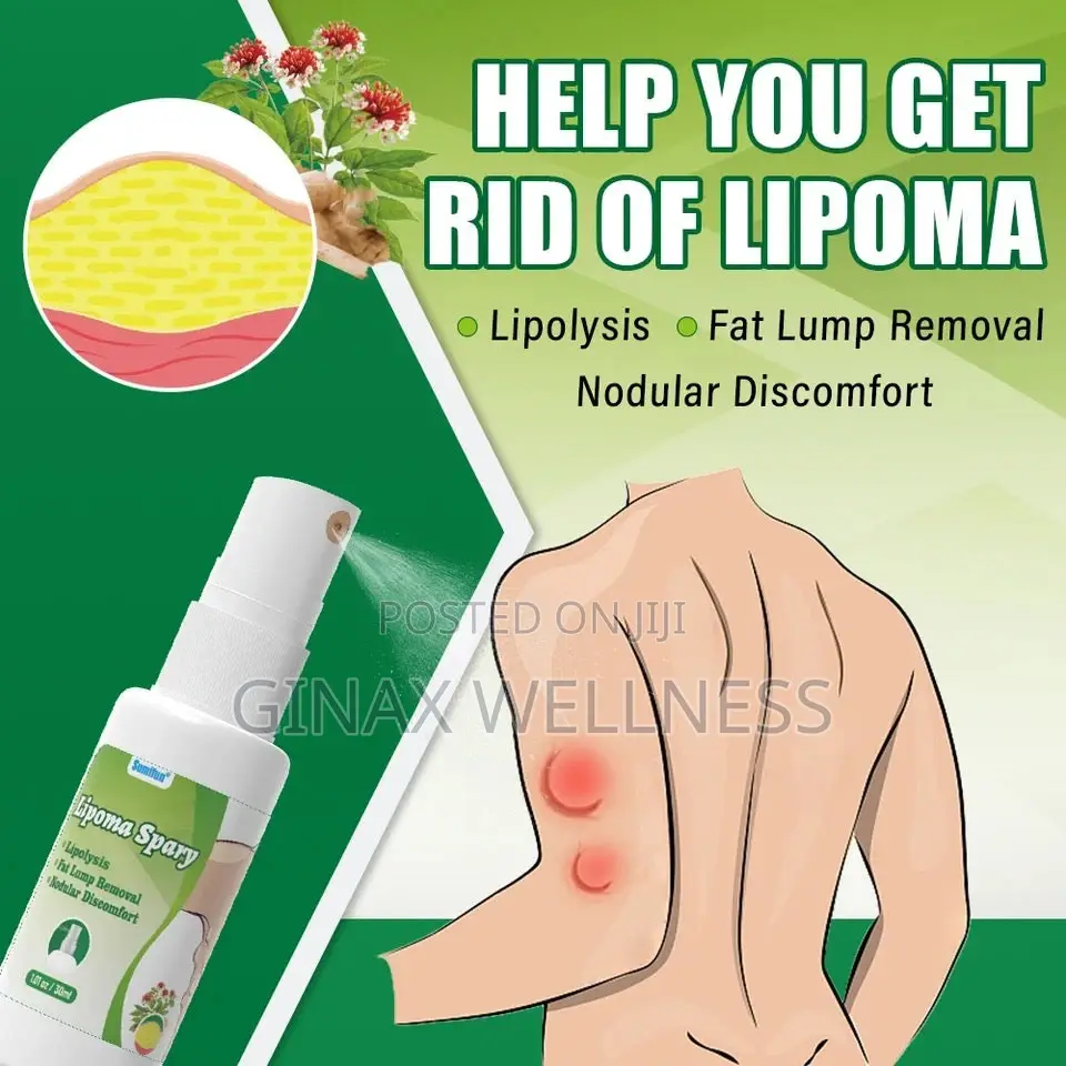 Lipoma Spray |Topical Spray For Skin Lump And Benign Lipoma