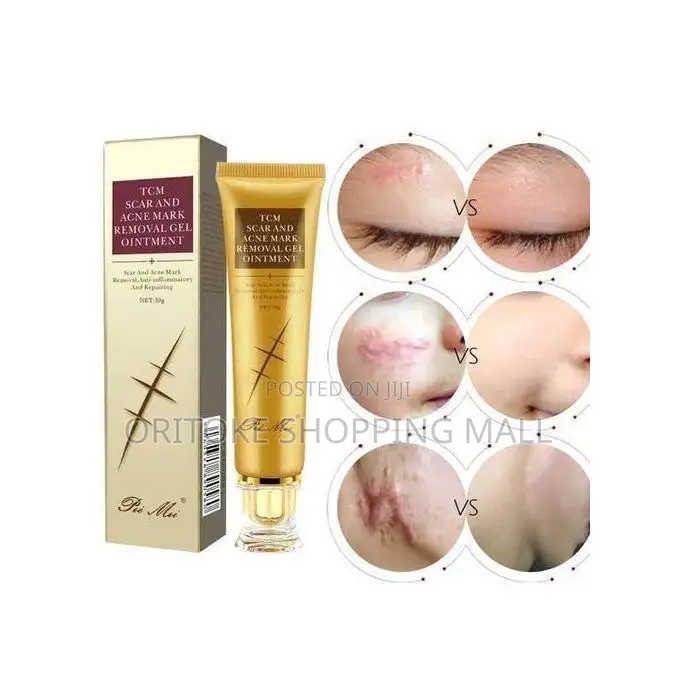 TCM Scar, Stretch Marks and Acne Removal Gel!(SKIN REPAIR )