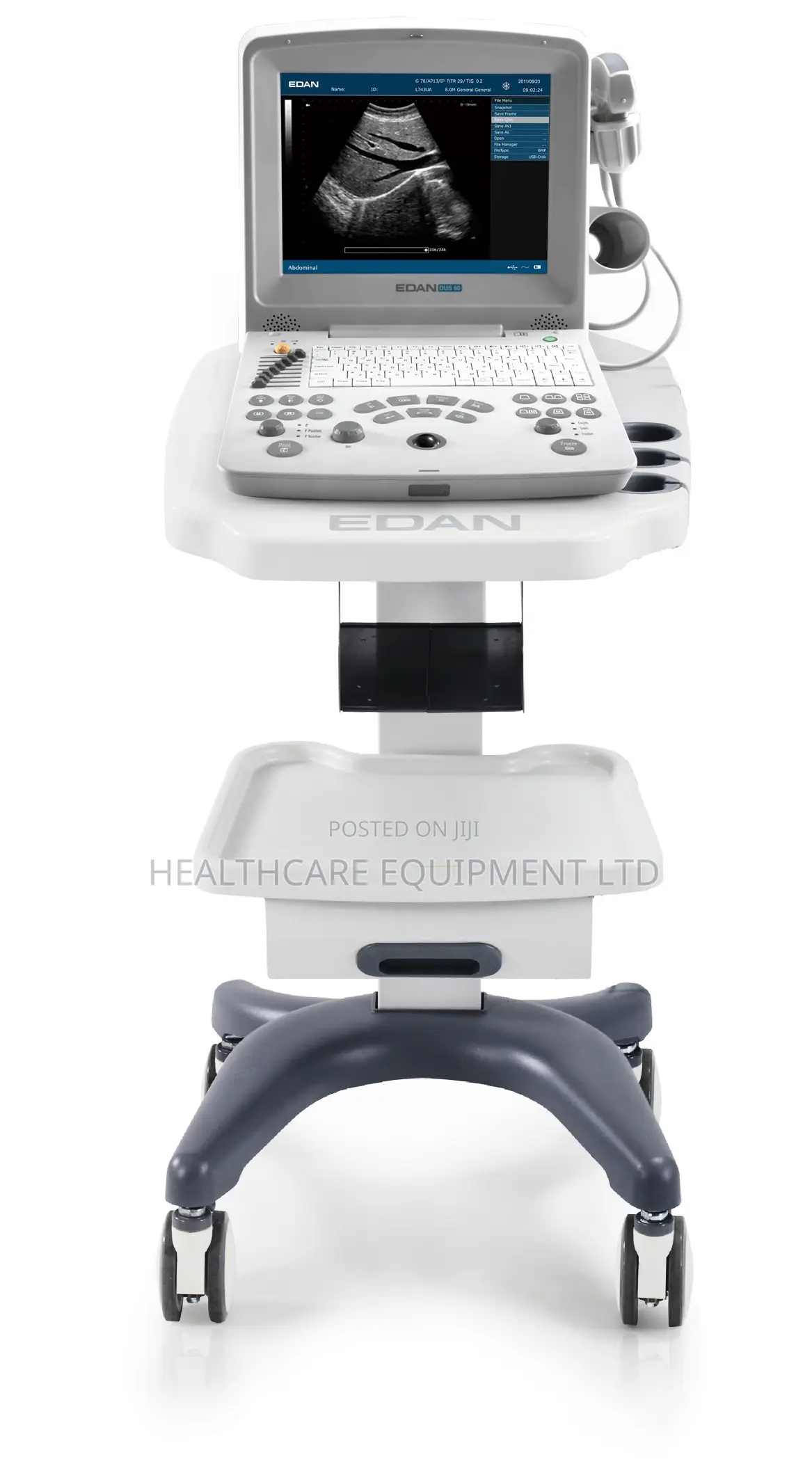 Edan Dus60 Ultrasound Machine