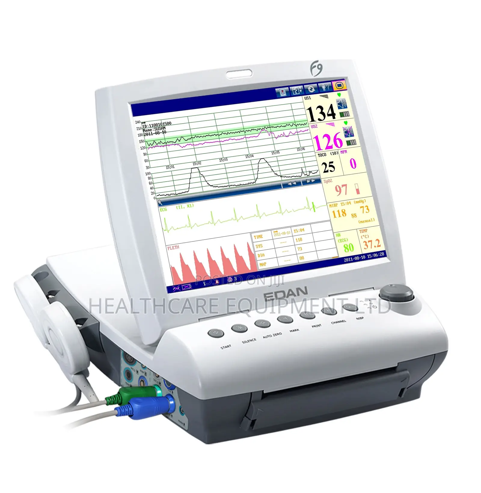 Edan F9 Series Fetal Maternal Monitor