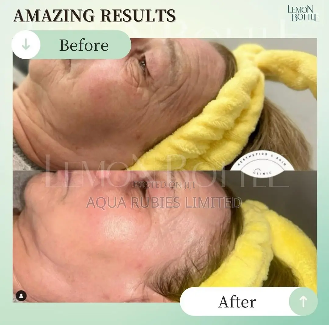 Lemon Bottle Skin Booster