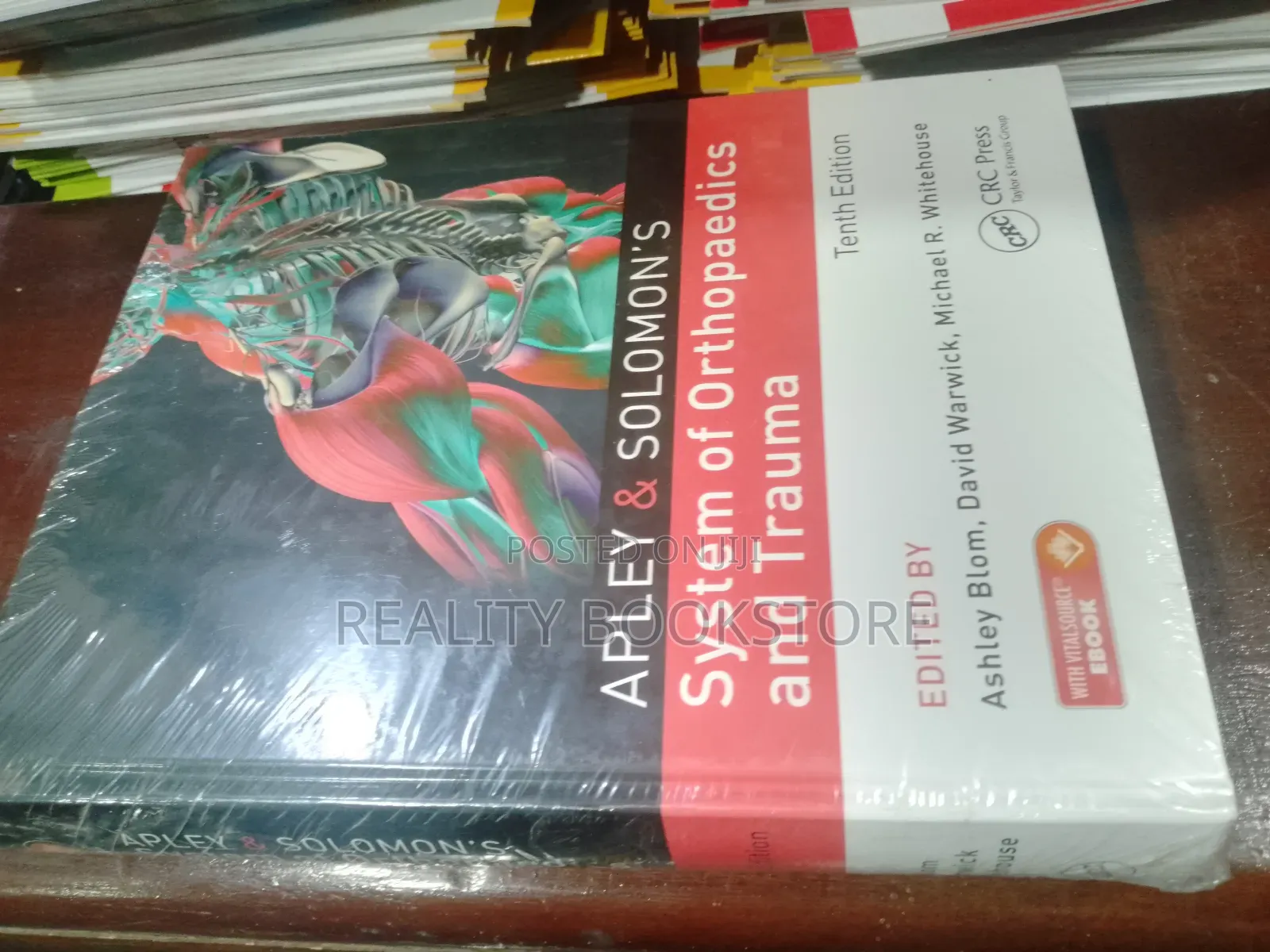 Appleys System of Orthopaedic and Trauma