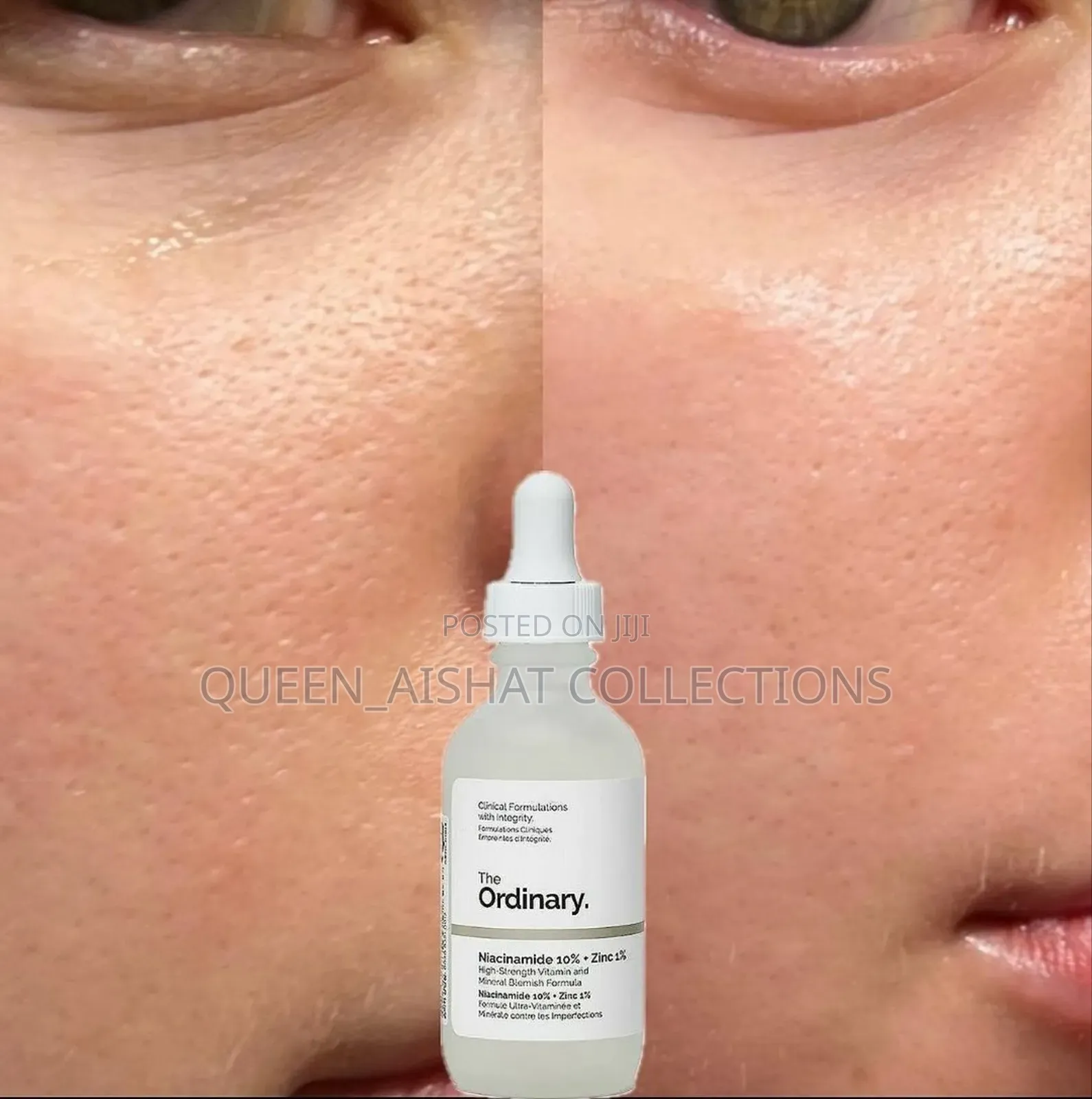 The Ordinary Niacinamide 10% + Zinc 1%