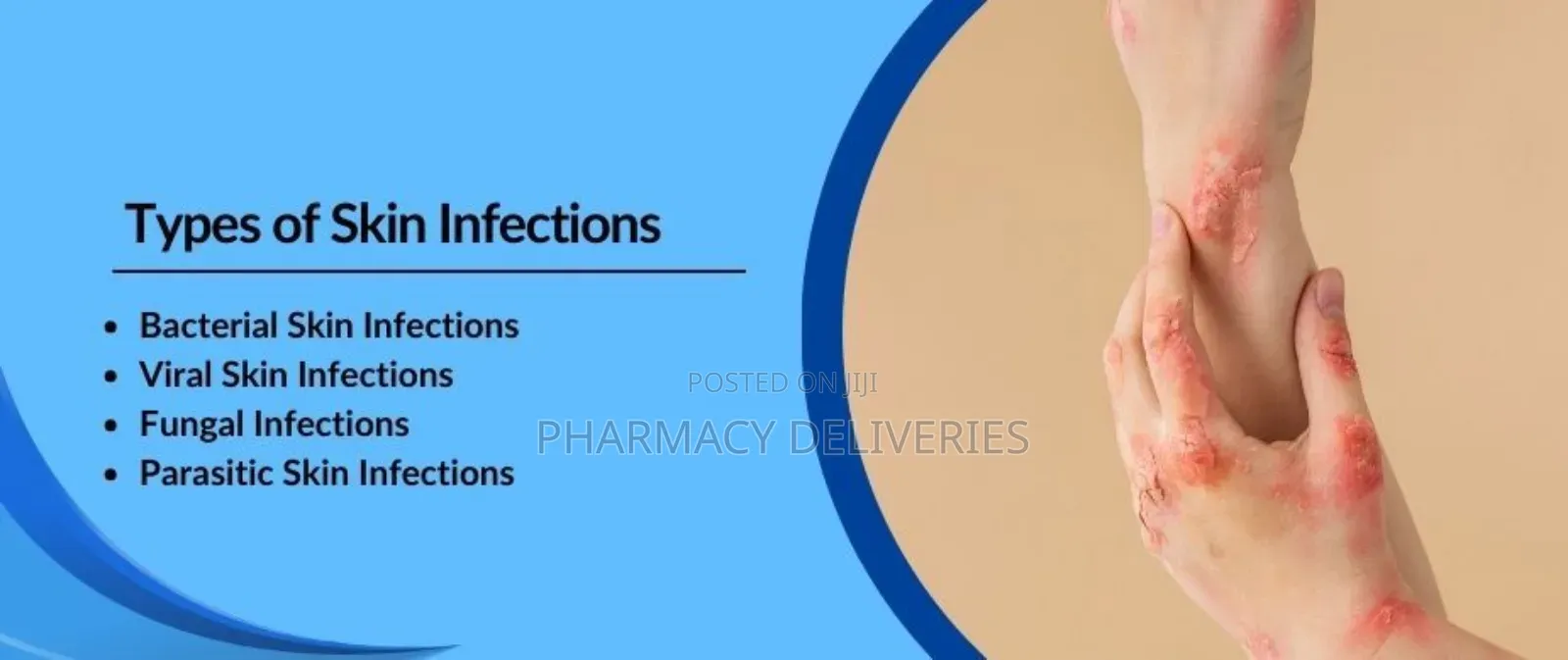 Treatment For Skin Parasitic Infection And Scabies Available