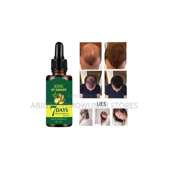 7 Days Ginger Hair Growth Oil