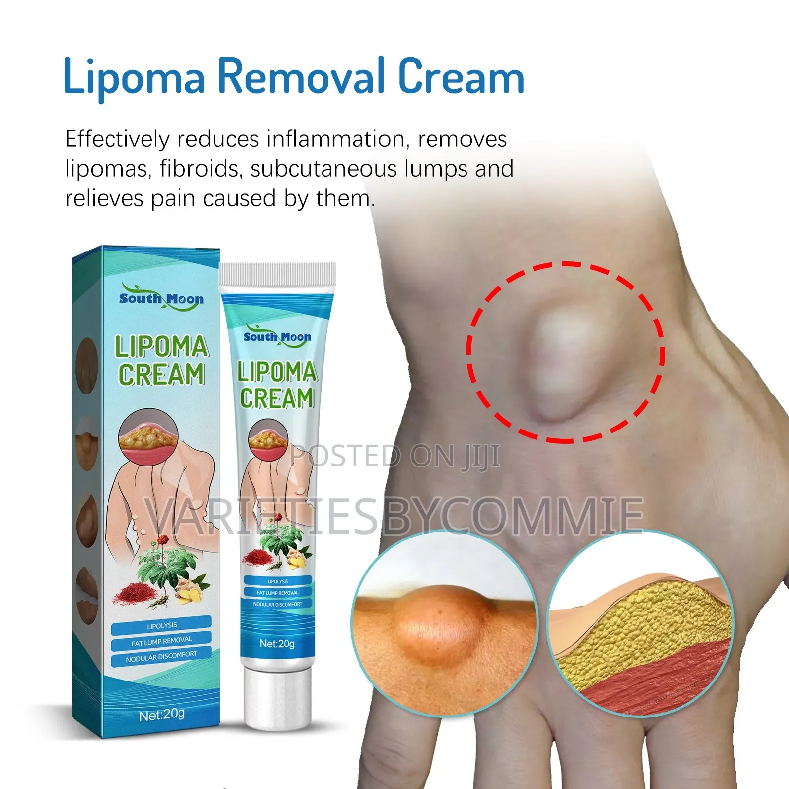 Lipoma Remover/Relief Cream