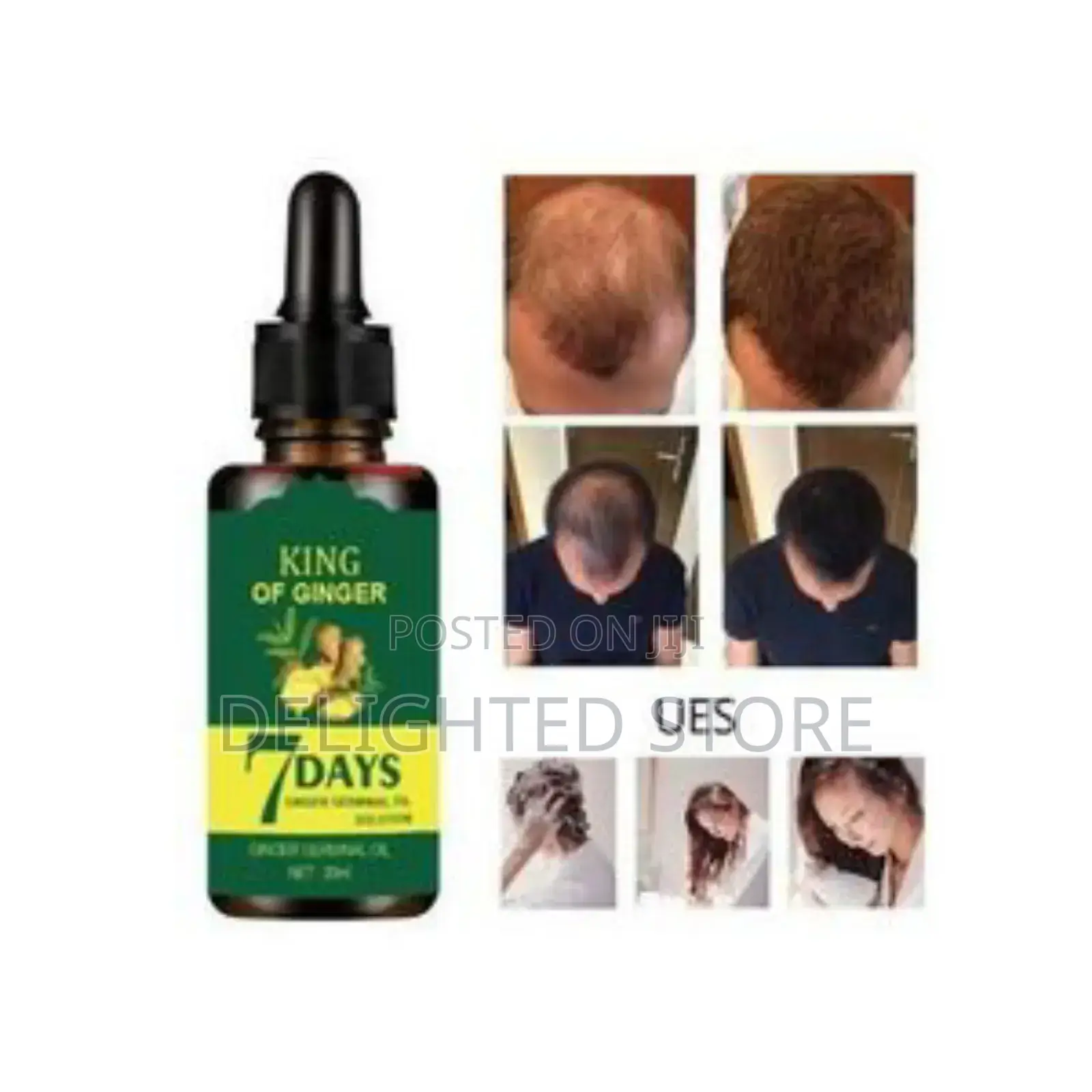 7days Ginger Germinal Hair Growth Oil