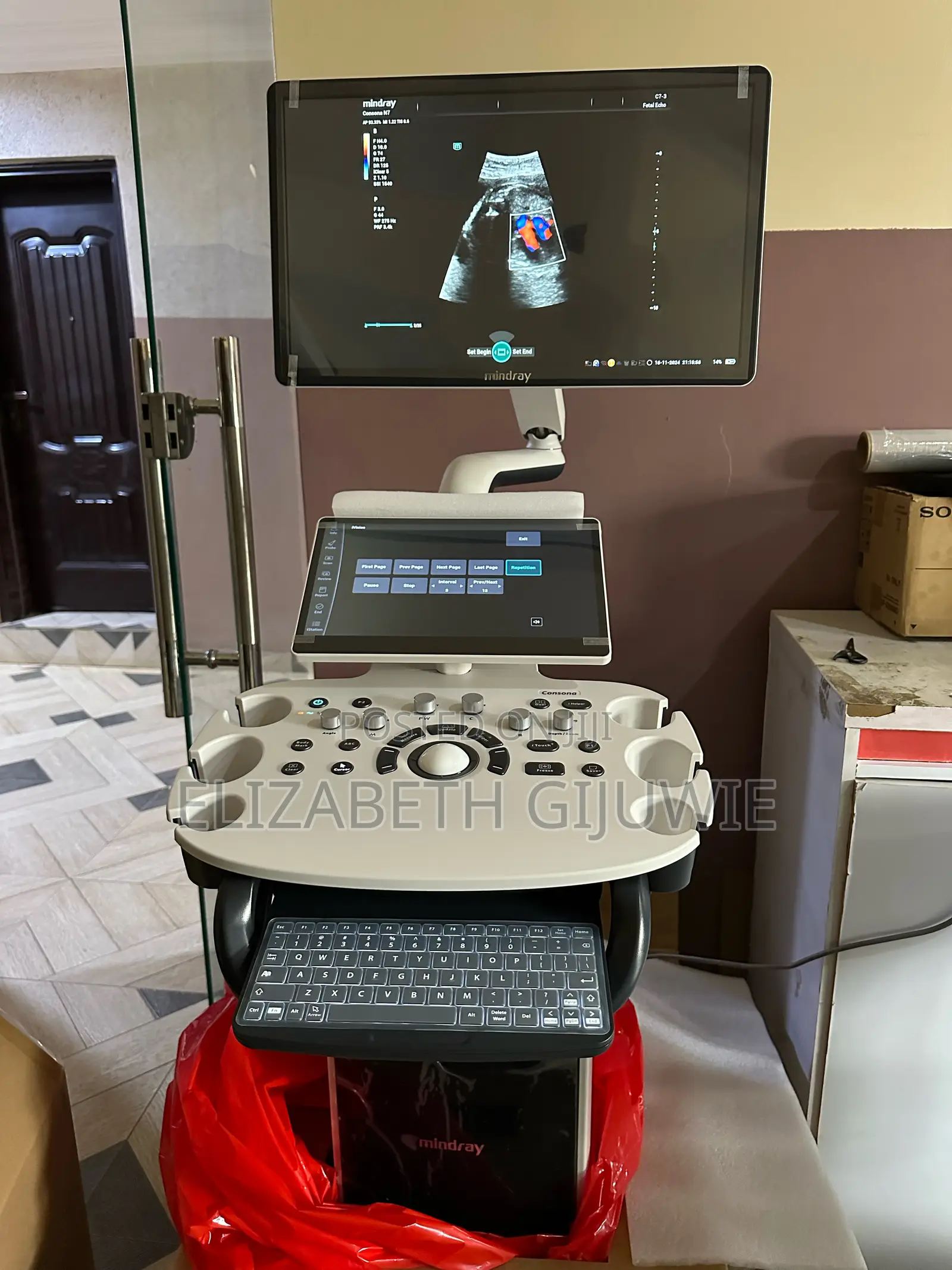 Mindray Consona N7 Ultrasound Machine