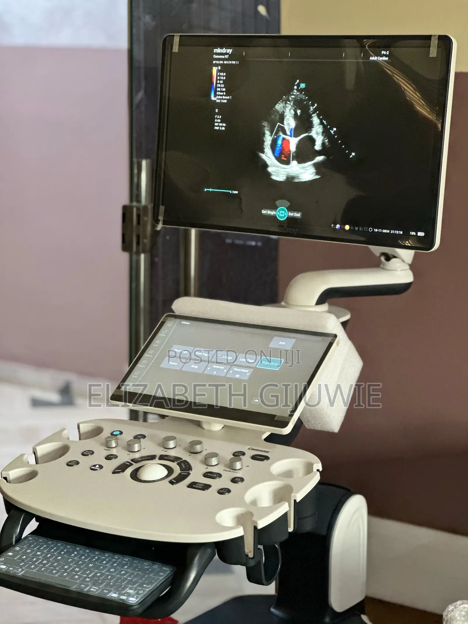 Mindray Consona N7 Ultrasound Machine