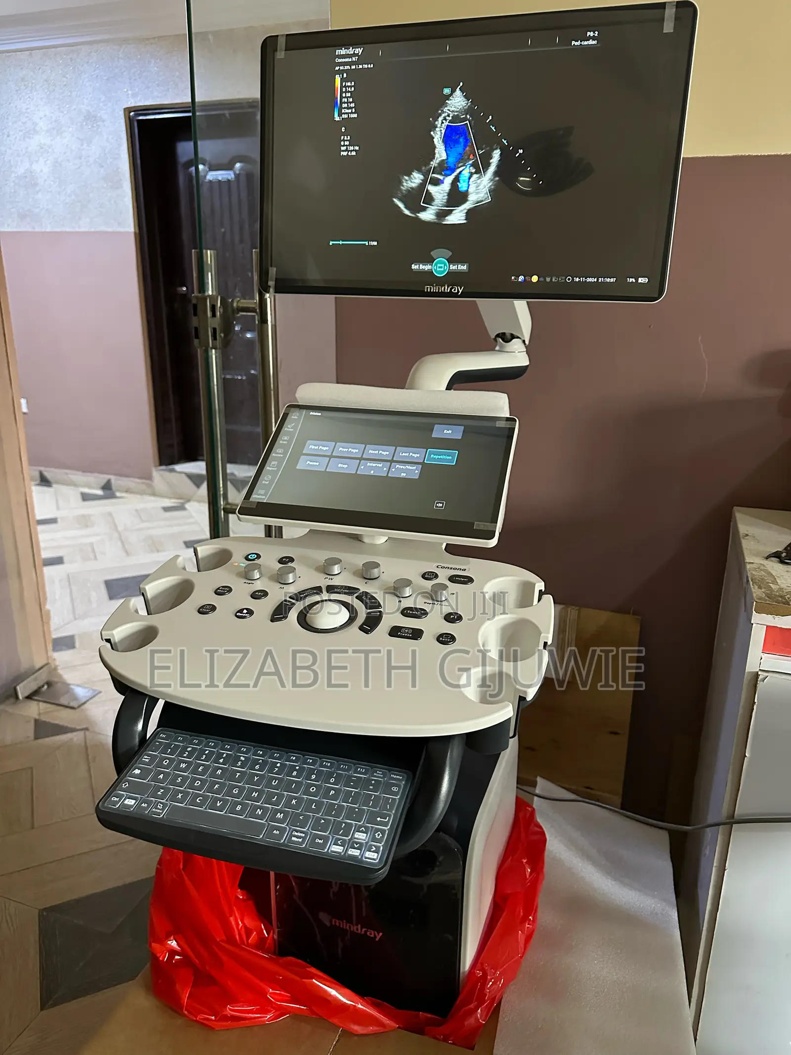 Mindray Consona N7 Ultrasound Machine
